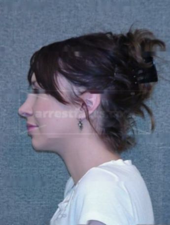 Lindsay B Kubicek