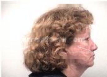 Susan Dirmeyer Kirk