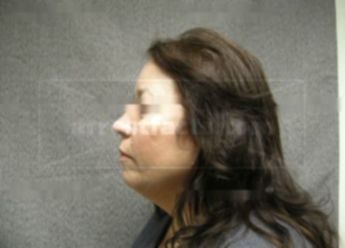 Donna L Treadway Lack