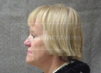 Kim L Harbison