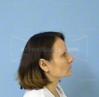 Bonnie Kay Rittenhouse