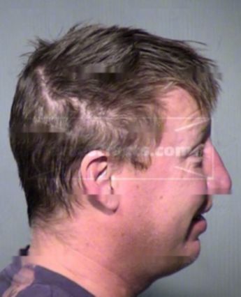Scott Allen Matteson