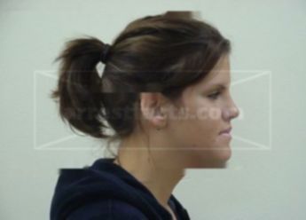 Sara A Berg