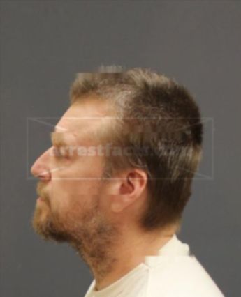 Kurt Alan Kluessendorf