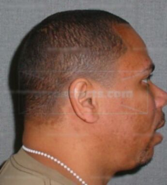Darrin L Mack