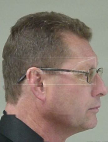 Gerald L Elgersma