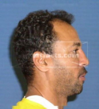 Luis R Colon