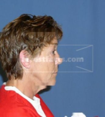 Susan A Herek