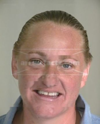 Holly L Lincks
