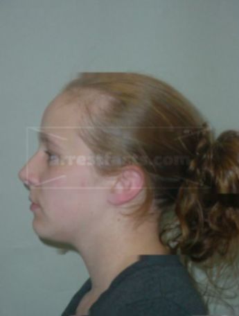 Rachel L Edges