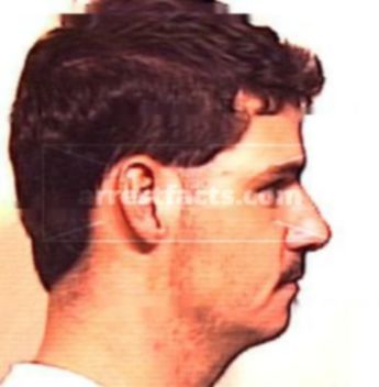 Lewis Kirk Posey
