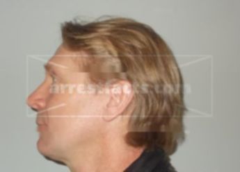 Jeffrey R Dickson