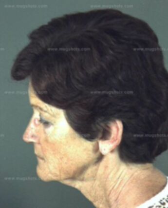 Arlene Ruth Redmon