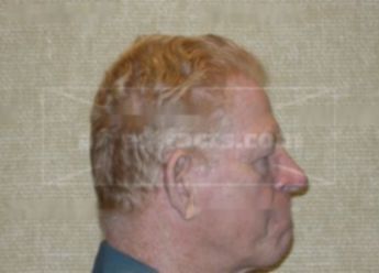 Duane Trossen