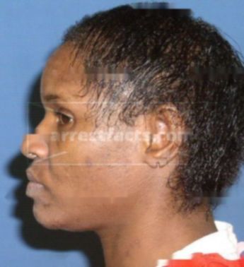 Cynthia D Brunson