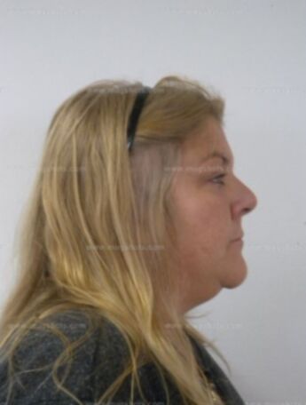 Sandra J Burritt