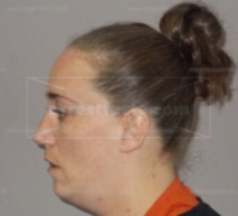 Melodie Lee Shreve