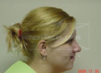 Teresa L Hennig