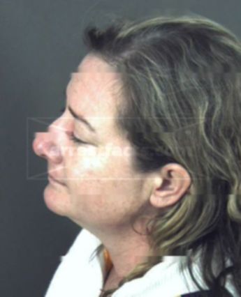 Cynthia Dehart Sullivan