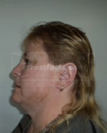 Debra Thurman