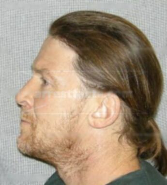 Gary Leonard Simmerling