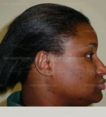 Vernessia L Parker