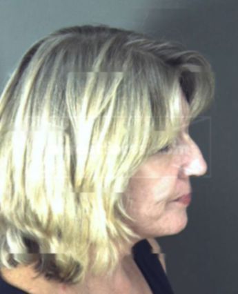 Laura Synek Braeunig