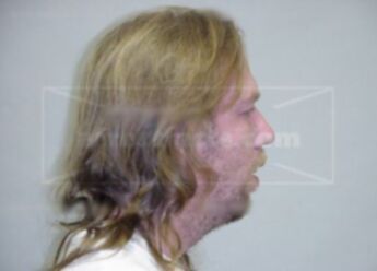 Timothy Allen Anderson