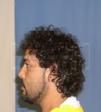Axel Burgos
