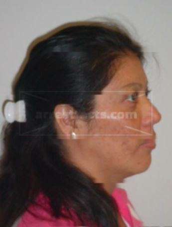 Lorena Coronado-Flores
