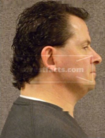 Shawn P Krawczyk