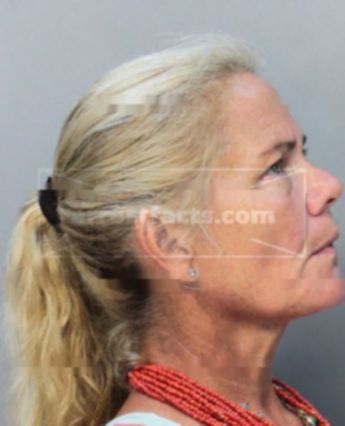 Kimberly Francis Ferguson