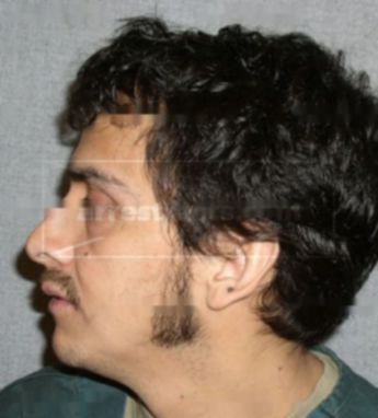 Fernando Zamora