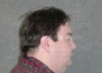 Phillip A Johnson
