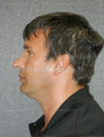 Ronald F Oehm