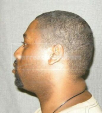 Branden L Neal