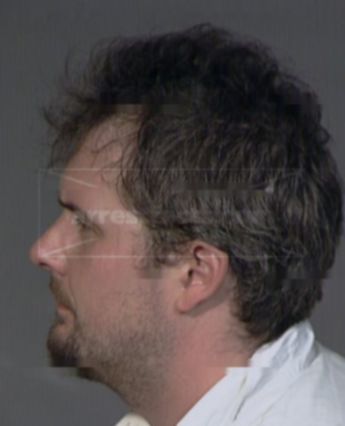 Bryce Patrick Oneill