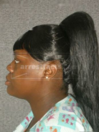 Latoya S Benson