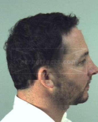 Anthony Lewis Marshall
