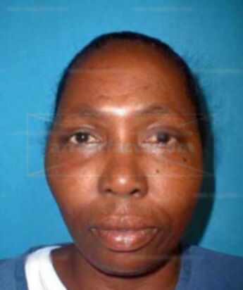 Glorida Mcneal