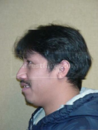 Lorenzo D Castellanos