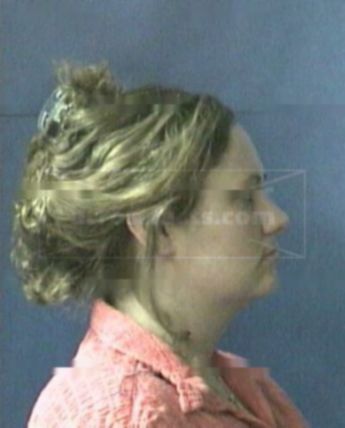 Teresa L Teague