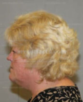Sandra Dee Eudave