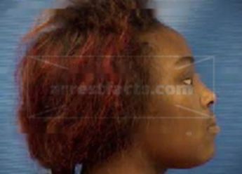 Cherona Latonya Speed