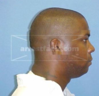 Lonnie D. Auent