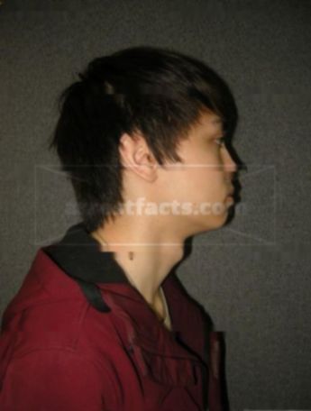 Anthony L Yang