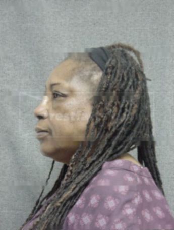 Eunice Head