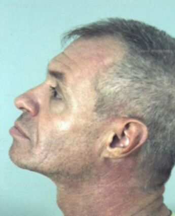 Anthony Harold Walton