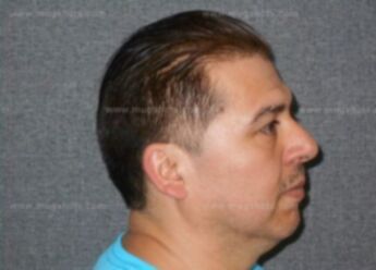 Jose Villa