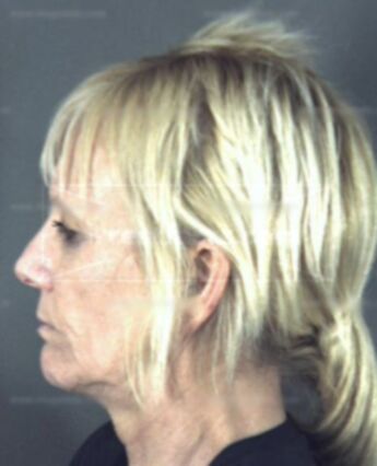 Anne Axman Smith